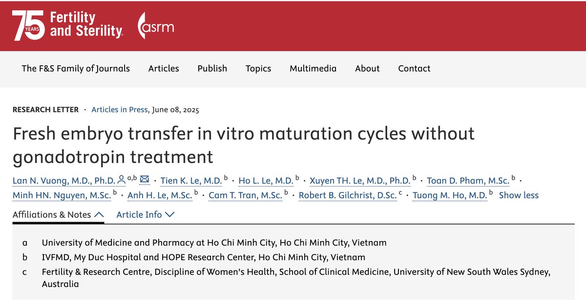 New protocol for IVM: The SAI GON Protocol | Fresh embryo transfer in IVM cycle without gonadotropin treatment | Beta-hCG positive per transfer was 73.3% | A revolution in ART !
