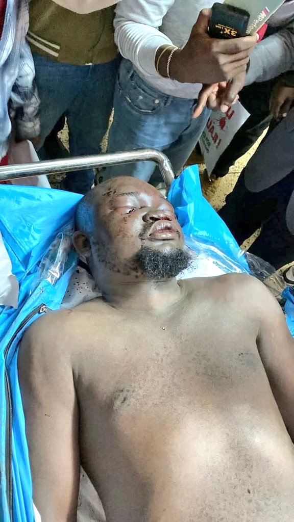 JaMtoka's tweet photo. A Policeman is not your friend.  #JusticeForAlbertOjwang https://t.co/SLAzszHElR