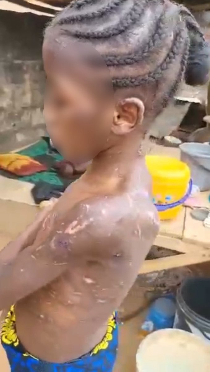 She is just 14 years old. A child.
Her name is Bashariya—but today, she represents countless Nigerian children whose innocence is violently snatched away behind closed doors, shielded by power, silenced by fear.

Read the full Press Release here: 👇🏿👇🏿
bit.ly/4kyZBlp
