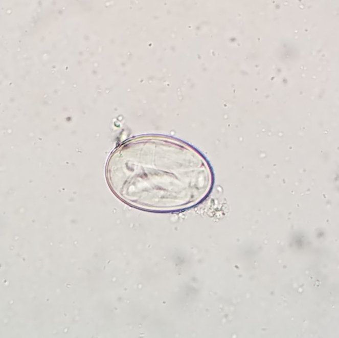 Vet_Parasites's tweet image. Physaloptera egg from a canine fecal. Physaloptera are spiruroid stomach nematodes that mainly infect wild carnivores. They have an indirect lifecycle involving an insect intermediate host, usually a cockroach, cricket or beetle #parasitology #parasites #vettech #Veterinary #dvm