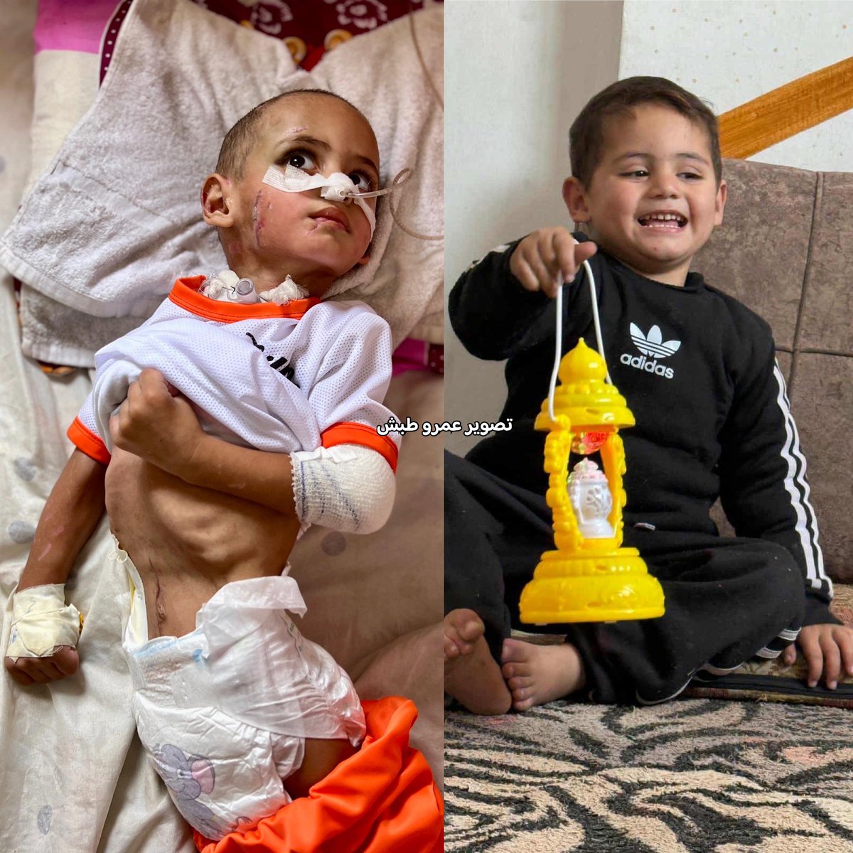 🌸 من تحت الركام.. صرخة اسمها "عمرو" 🌸

في فلسطين، لا توجد ملاجئ آمنة ولا طفولة محميّة.
الاحتلال الإسرائيلي لا يفرّق بين صغير وكبير، بين لعبة وهدف عسكري.
وفي كل قصفٍ، تسقط أحلام بريئة وقلوب صغيرة لم تتعلم بعد معنى الخوف.
💔 قصة الطفل عمرو الهمص (3 سنوات) تختصر حكاية وطن مجروح: