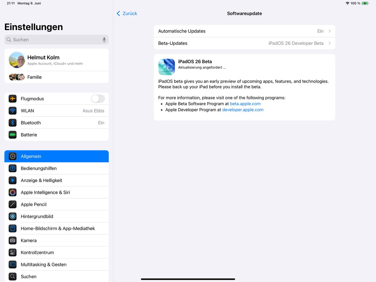 Noch schnell die Beta installieren 😏🙈