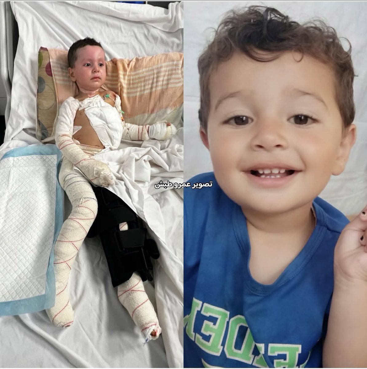 If you see this pic, reply with 🍉🇵🇸 and pray for him. 💔