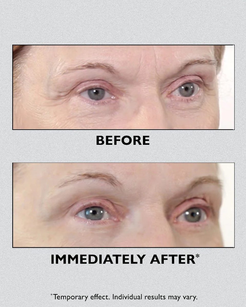 PTRskin's tweet photo. Check your eye baggage at the door (aka @Sephora!) Instantly tighten, firm and smooth* the look of under-eye bags, crow's feet and puffiness with Instant FIRMx® Eye Temporary Eye Tightener.

*Temporary effect. Individual results may vary. https://t.co/1c9sPxdG3C