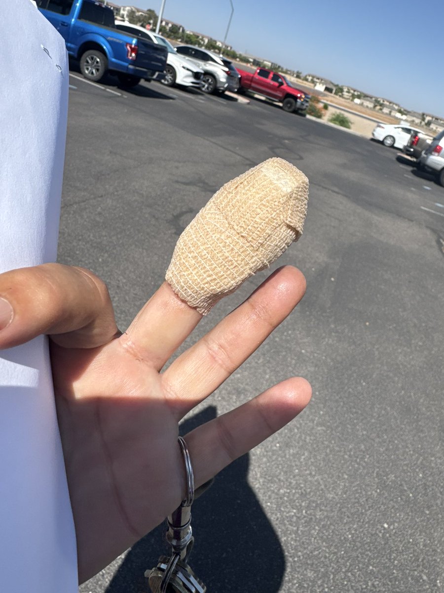 So this happened at work Friday and this is my finger after today’s hand surgeon appt. No surgery just let it heal.