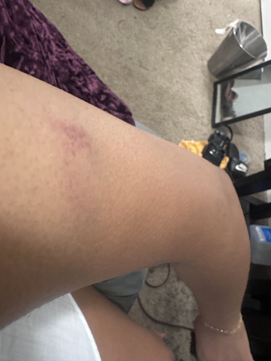 wootabear's tweet photo. This is what being a big ass kid got me😂 that spiny thing spun my ass and I flew I wish I could’ve got a video https://t.co/KUGavZLNnY