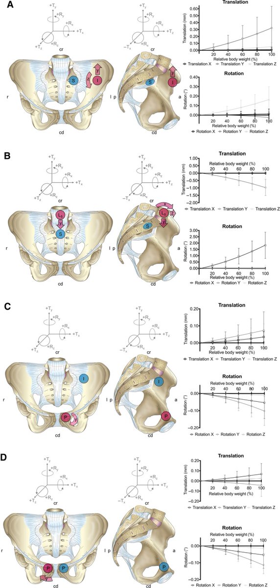 DavidMackeyDPT's tweet photo. SIJ motion? Barely there. This study supports that SIJ is built for stability, not big movements. Under physiological loads, the lumbosacral junction does the heavy lifting. Is our field overdiagnosing &amp; overtreating SIJ dysfunction?
https://t.co/4ON87jUCjK https://t.co/lU1bBRGZI1