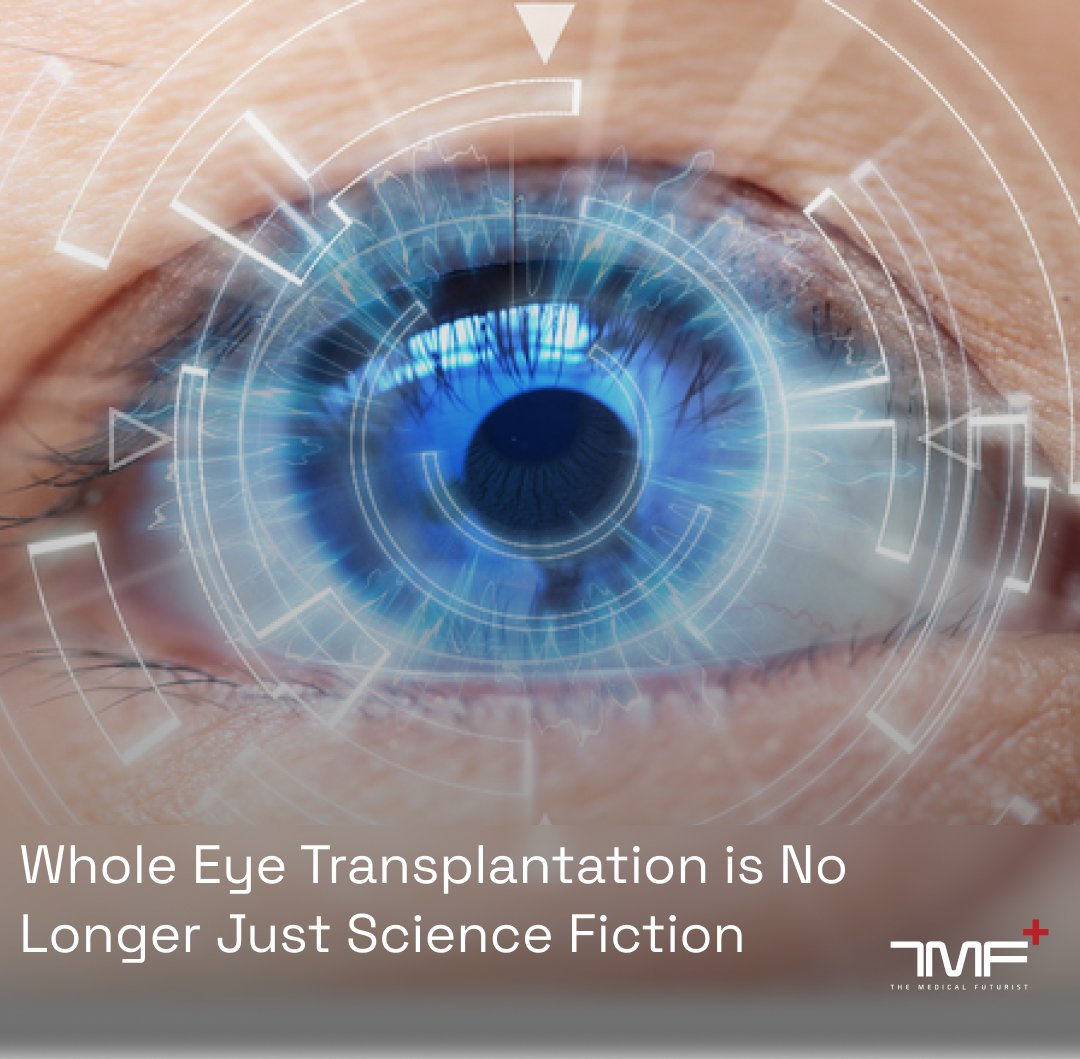 According to experts, eye transplantation might not be impossible anymore!

Whole eye transplantation (WET) is a highly ambitious effort, and several groundbreaking advancements must be made for WET to work. But there have been good signs:

"...a military veteran involved in a