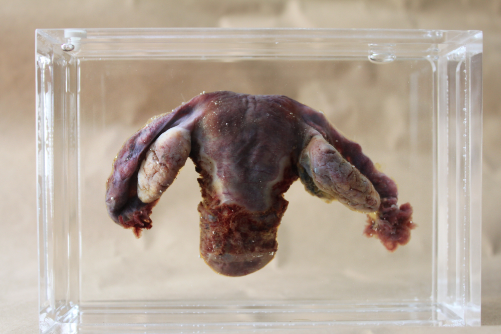 We post a lot of gynaecological anatomy facts on here, but sometimes what really drives it home is looking at the real deal. Here's a few things you can learn from looking at the human uterus, uterine tubes and ovaries, which will go on display at the Vagina Museum on 27th June.