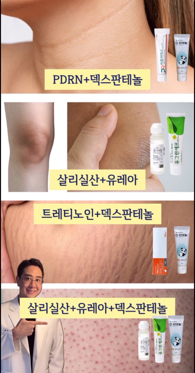 韓国の薬局で買えるこのクリーム一覧の、
ケロイド用のクリーム本当に効くからみんな買ってほしい。。。
脂肪吸引の跡に塗ってたら傷跡何もなくなった🥳