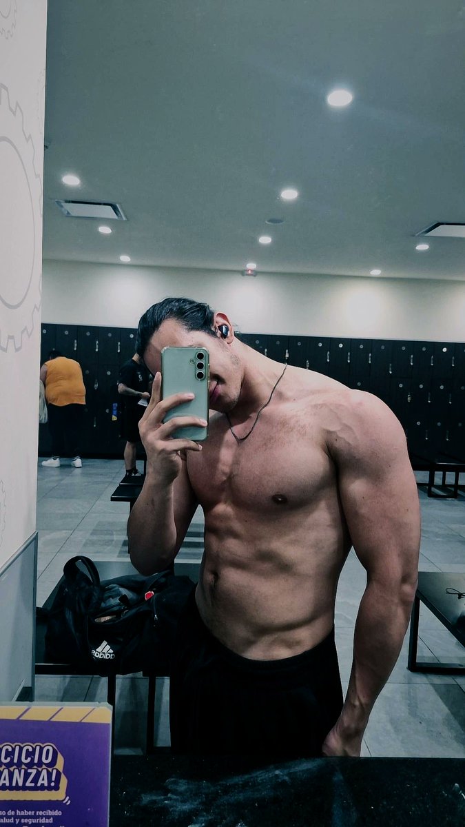 La dismorfia está fuerte...