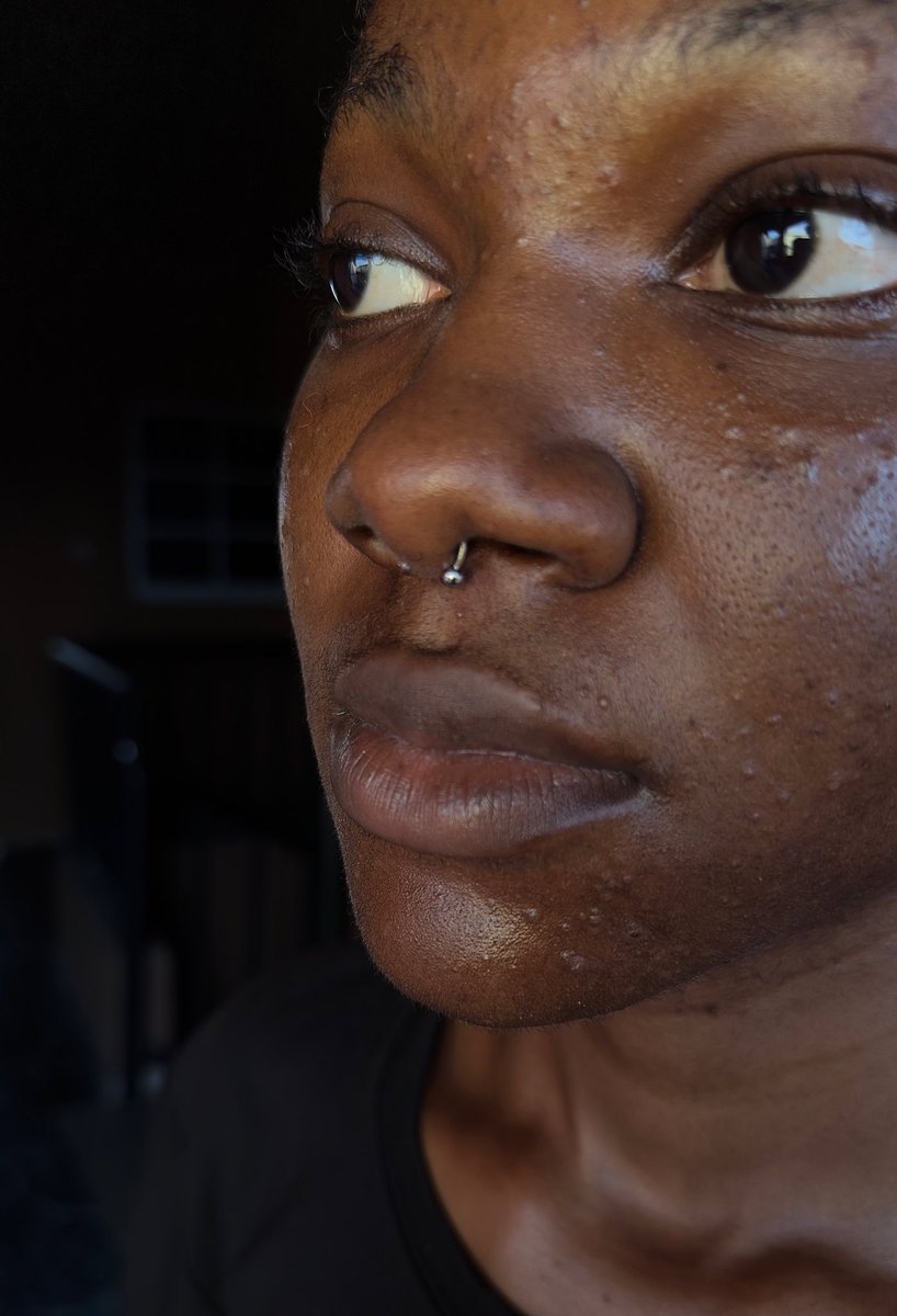 dpierced_'s tweet photo. dainty septum ring and a fine client
💗Septum Piercing 
💗 Price: ₦8,000 https://t.co/yaacm3g0CK