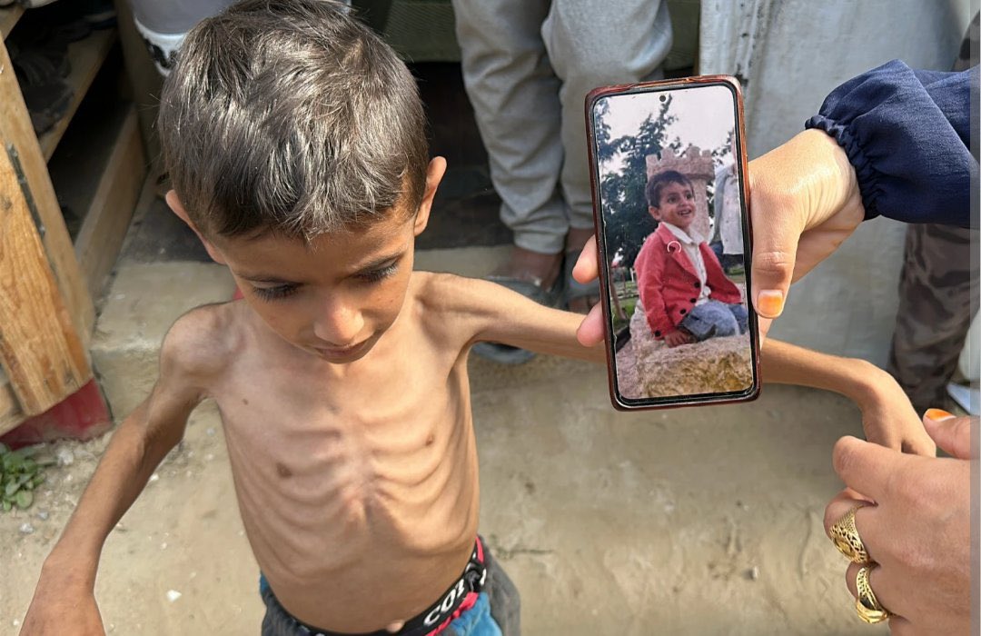Gaza doesn’t have enough food for the children. Don’t stop talking about Gaza.