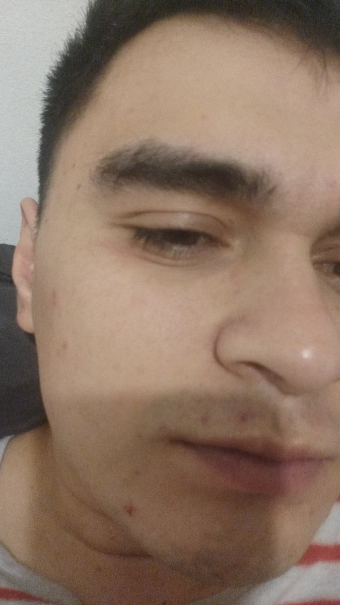 anticorrup555's tweet photo. Ahora si yo soy miguel alejandro troncozo yañez lo cual tengo persecucion politica y quieren reemplazar mi cara y mis genes y adn para luego mal utilizarlo elonk musk esta en peligro y donal trump  le jugara una mala pasada y tambien elonk lo puedo traicionar cuidado canada con todo