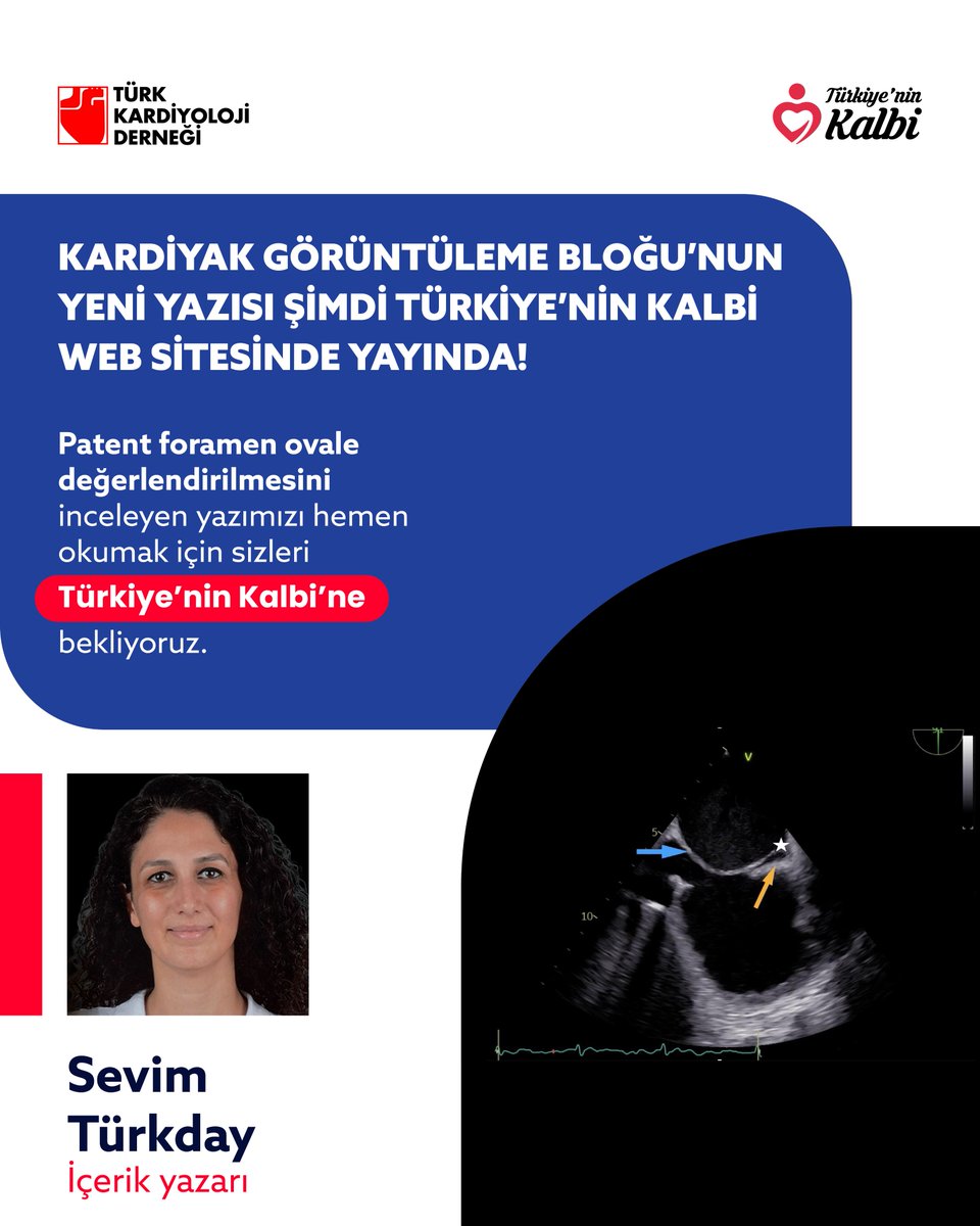 Kardiyak Görüntüleme Bloğu’nda yayınlanan, patent foramen ovale değerlendirilmesini inceleyen yazımıza Türkiye’nin Kalbi web sitemizden, uzman girişiyle ulaşabilirsiniz.
turkiyeninkalbi.com/uzman/koleksiy…

#TürkKardiyolojiDerneği #TKD #KardiyakGörüntülemeBloğu