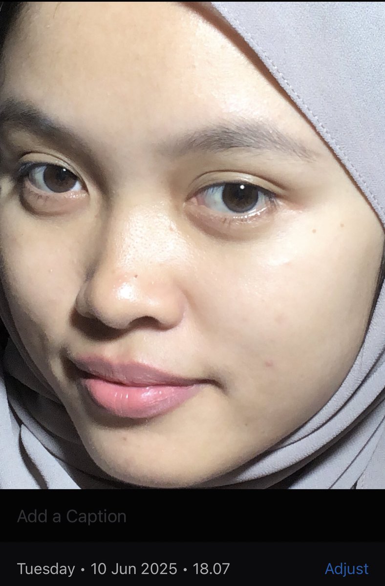 from this.                    to this

hasil serum high end cuma pake produk lokal, berasa banget muka makin mulus🥹🫶🏻