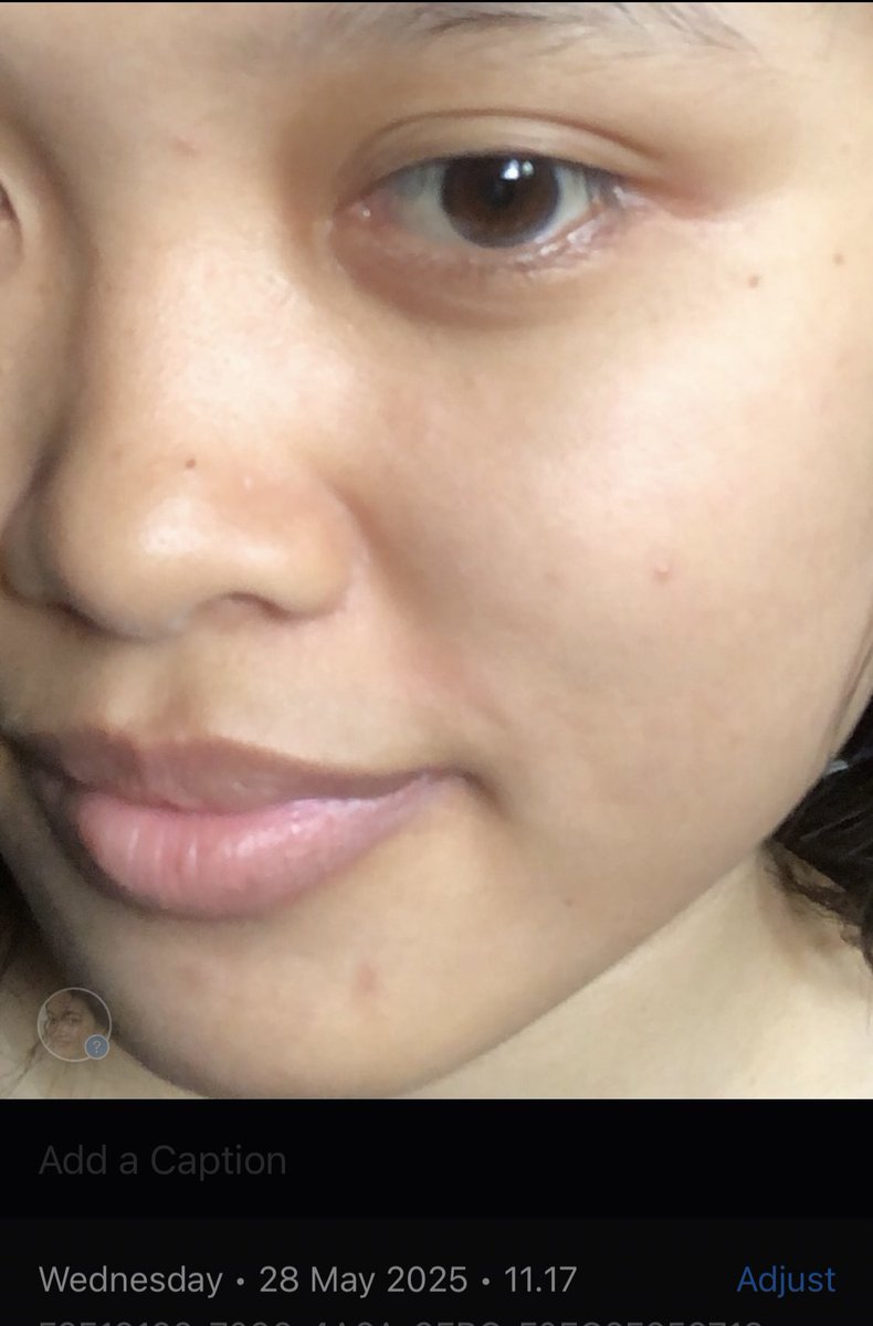 kiaaaaca's tweet photo. from this.                    to this

hasil serum high end cuma pake produk lokal, berasa banget muka makin mulus🥹🫶🏻 https://t.co/8DJt5qHAB6