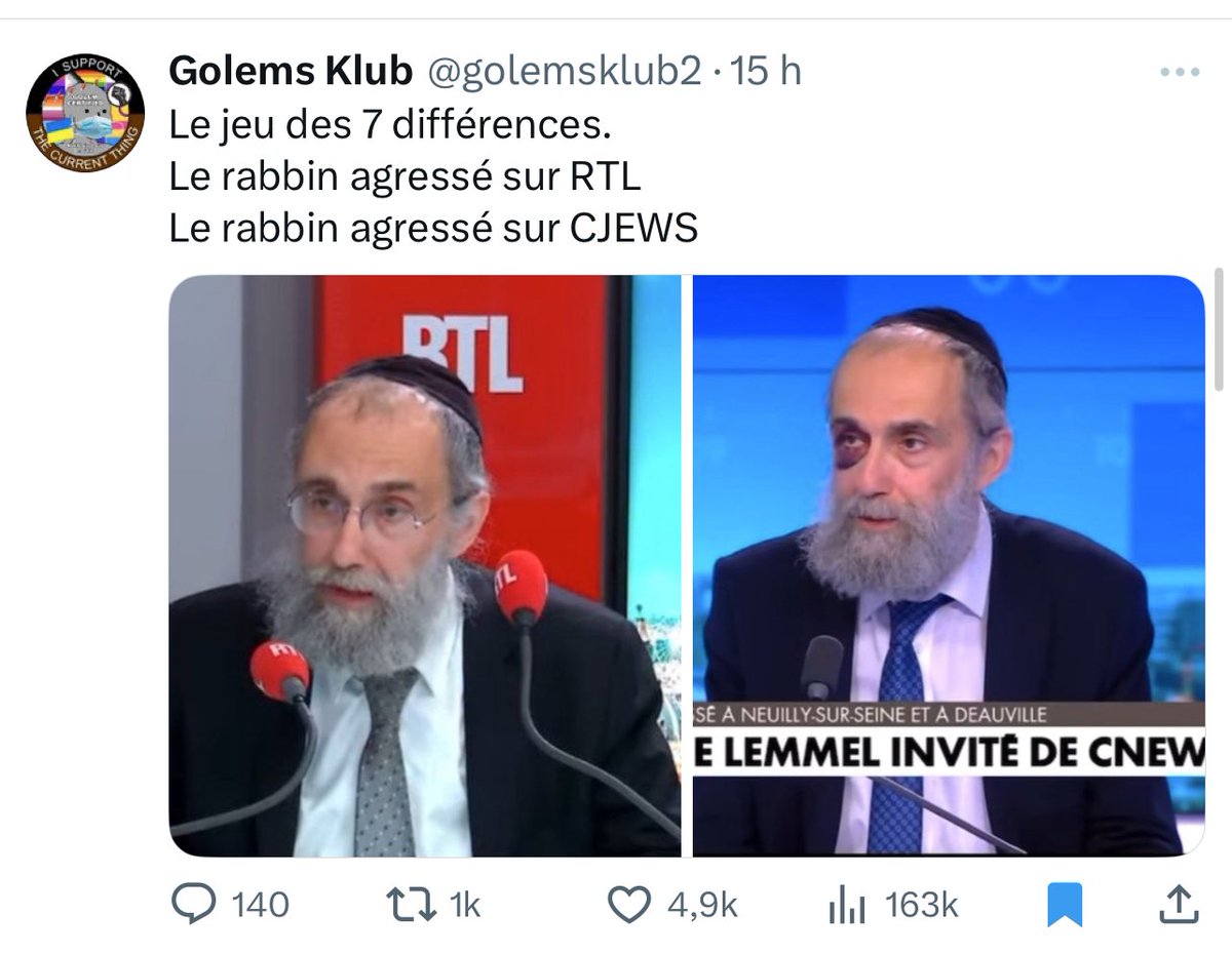 Bcp de tweets complo mettent en doute les séquelles de l'agression du rabbin Elie Lemmel.

Je vous encourage à aller voir comment évolue une ecchymose et à vous demander pourquoi vous êtes si perméables à ce genre de théories lorsqu'il est question d'antisémitisme.