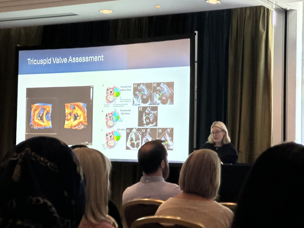 Vera Lennie (@veralennie) on Twitter photo Fantastic presentation on right heart valves from the amazing and wise <a href="/amandahunter83/">Amanda Hunter</a> #advancedecho2025 Fantastic presentation on right heart valves from the amazing and wise <a href="/amandahunter83/">Amanda Hunter</a> #advancedecho2025