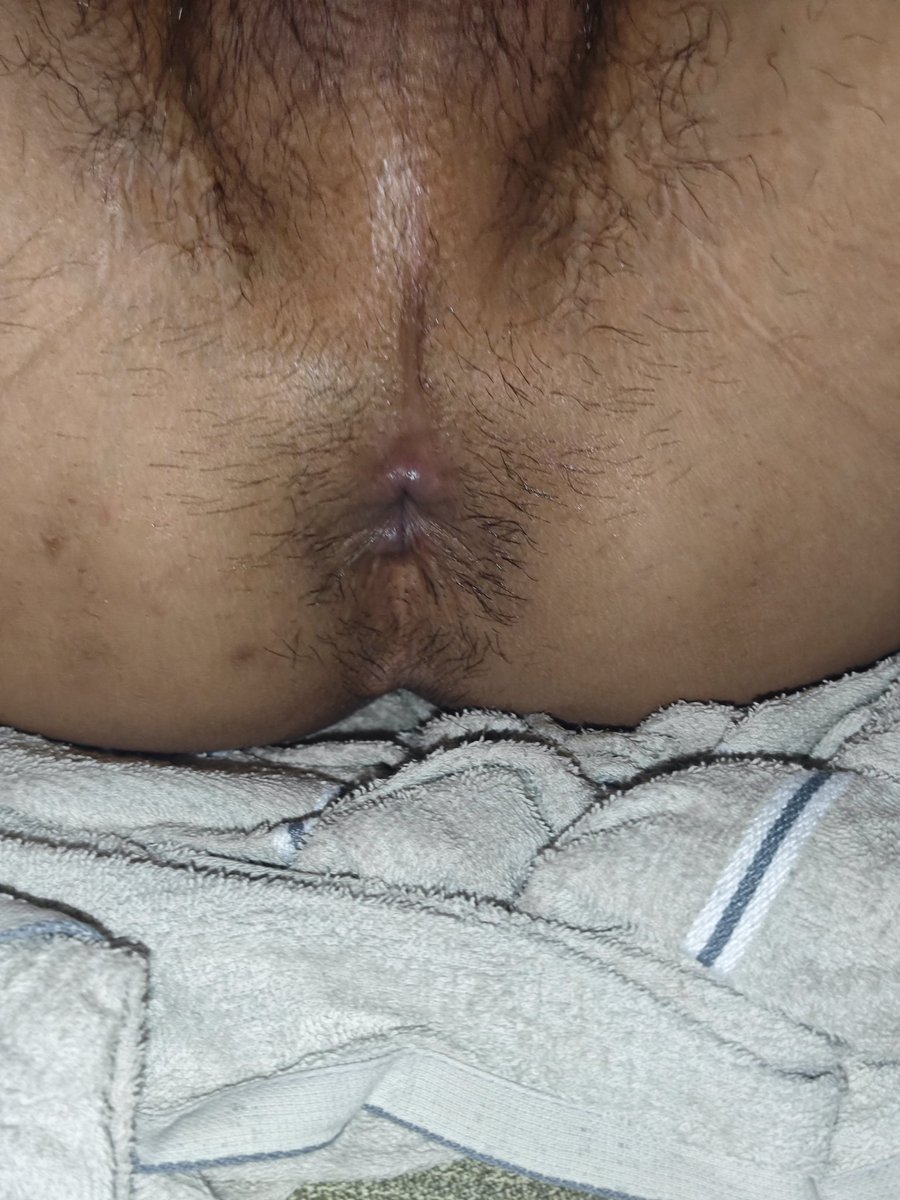 AURORA_Y tweet media