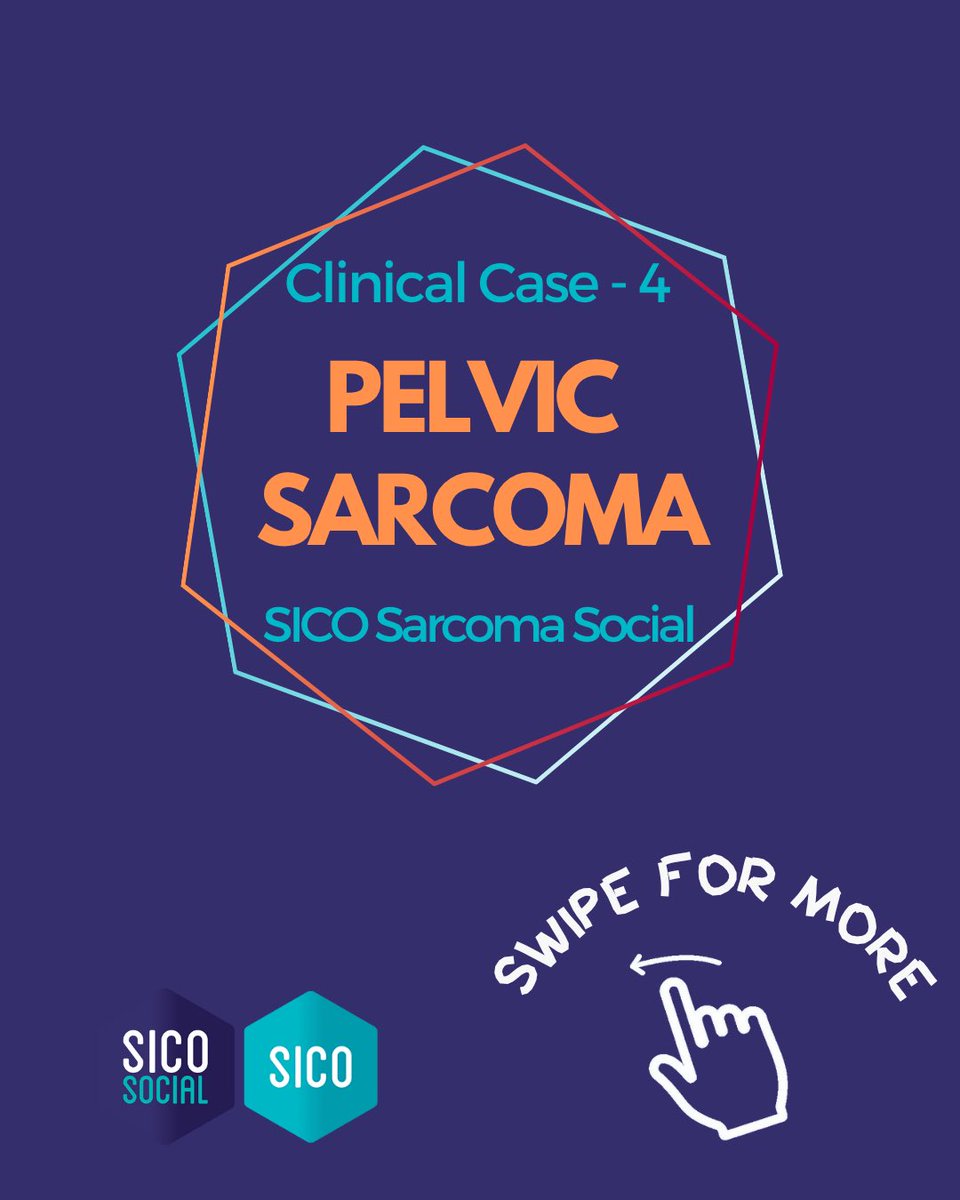 oncoteamsarcoma's tweet image. ‼️ Pelvic Sarcoma
A Solitary Fibrous Tumor managed at the Sarcoma Surgery Unit, @HumanitasMilano (Dir. @FCMCananzi ).
#SarcomaSurgery #Teamwork #SICOSarcomaSocial #SurgicalOncology #RareTumors