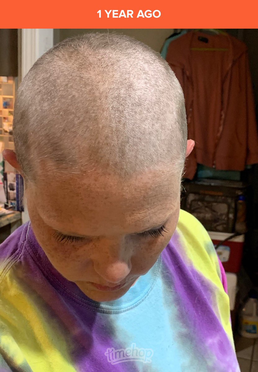 KickEthanKick's tweet photo. 1 year ago today I had to shave my head for #brainsurgery . Somehow I kept back the tears. Ethan has been my biggest supporter through it all! #essentialtremor  #DBS #dbssurgery https://t.co/pZ0H65N9rV