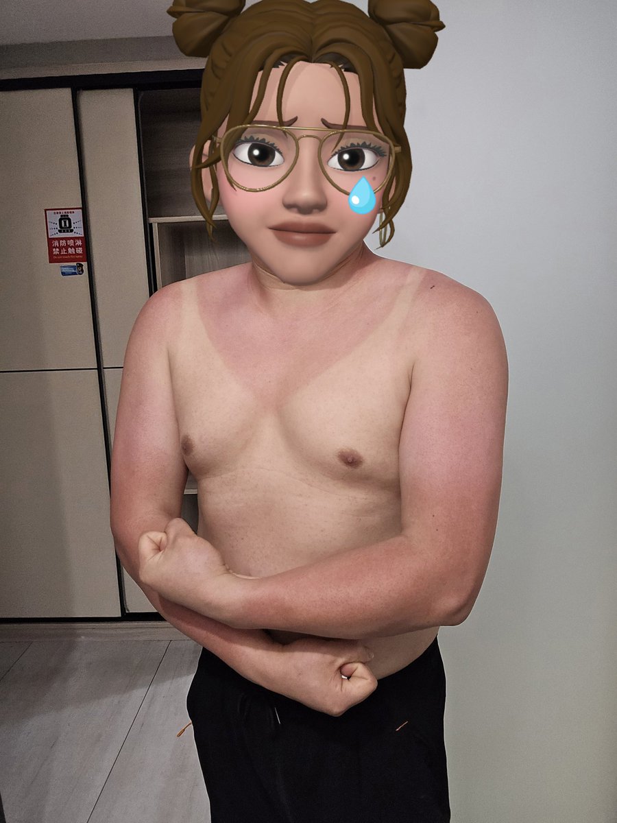 不要在炎炎夏日的中午去爬山。
不要像我这种脑子有坑的人学习。
没涂防晒霜，会晒伤，会留痕迹。😭😭😭😭😭
#户外露出 #户外野裸 #贞操锁 #丝袜男