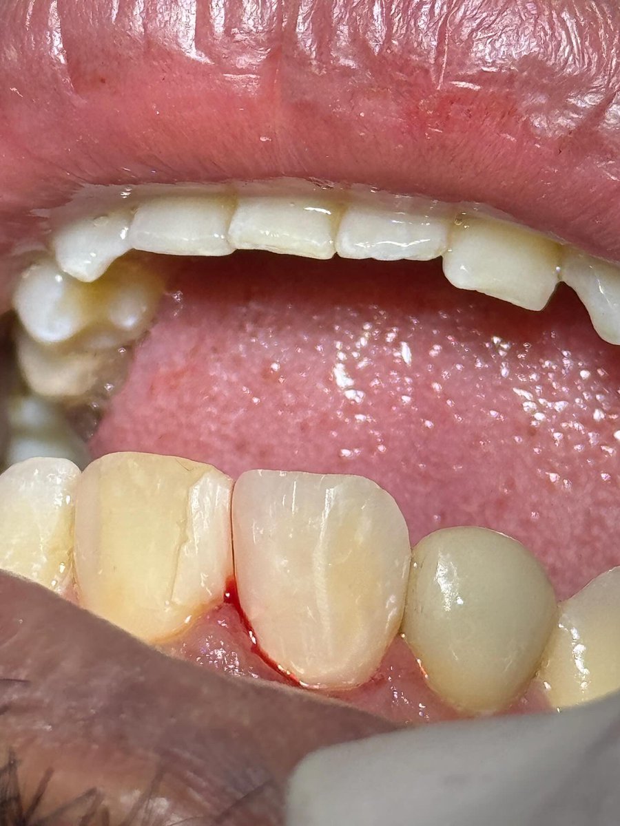 ساعد الغامدي tweet media