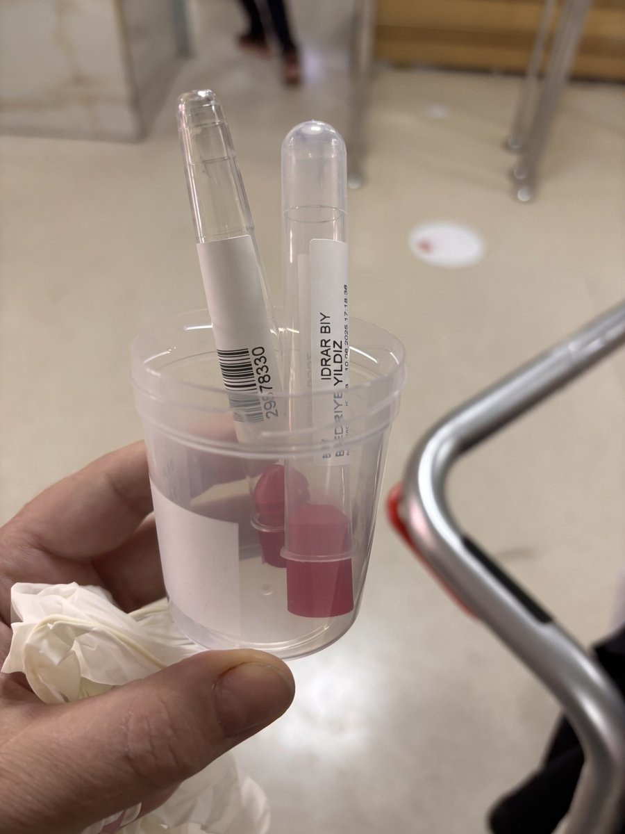 #GAÜN tıp fakültesiBu kutuyu eline verip içine çiş yap ve tekrar o tüplere doldur diyorlar.77 yaşında tekerlekli sandalyede  düşme problemi yaşayan hastaya diyorlar. Bu bir sağlık ve hijyen skandalı. İnsanlar bu kadar değersiz mi, çişiyle oynasınlar <a href="/TCSaglikBknligi/">TC Sağlık Bakanlığı</a>