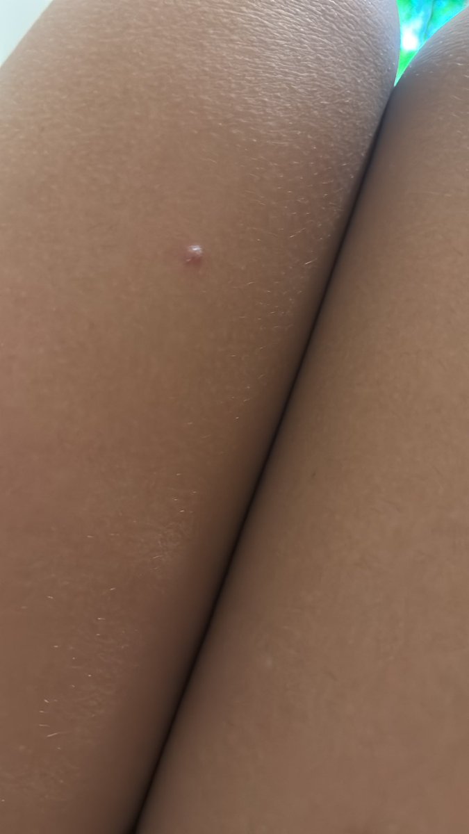 الي يبي اعرض له يجي خاص بمقابل 

لا يجي الا الصامل