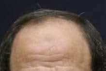 الصلعة الوحيدة الي مخوفتني أكثر من 🇮🇱