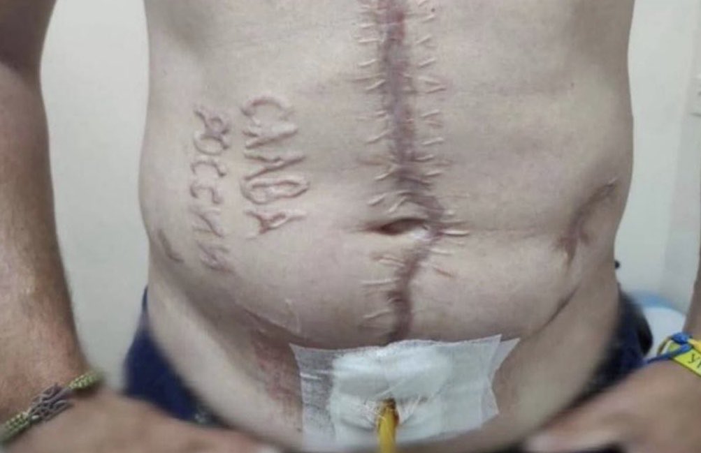 18+

Фото українського військового після російського полону 

путін - ХУЙЛО
росія - країна-гній