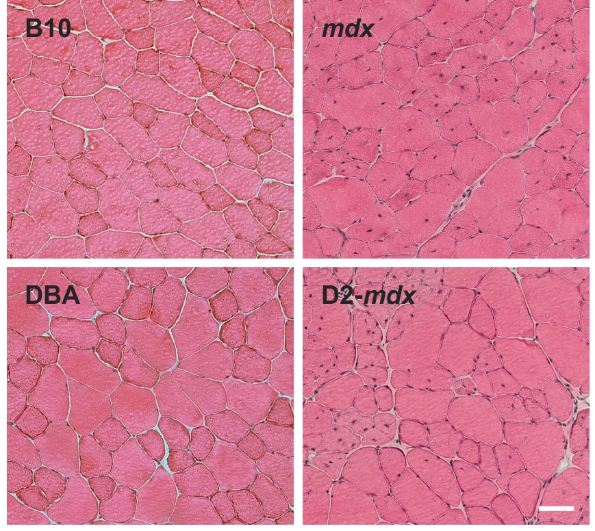 Dr. <a href="/chang_natasha/">Natasha Chang</a>'s team at <a href="/mcgillu/">McGill University</a> determined how dystrophin deficiency impacts the satellite cell transcriptome and cellular composition by comparing satellite cells from mdx and the more severe D2-mdx Duchenne muscular dystrophy mouse models. 🐁 

go.nature.com/3HBCibZ