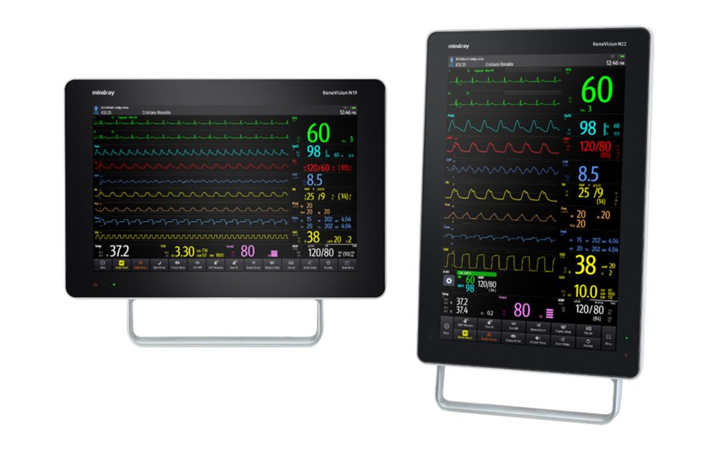 A new spin on high acuity patient monitoring
The BeneVision N19 and N22 are part of Mindray’s premier patient monitoring solution designed to enhance patient care and support timely and accurate clinical assessment across Emergency, Critical Care, and Operating Room environments.