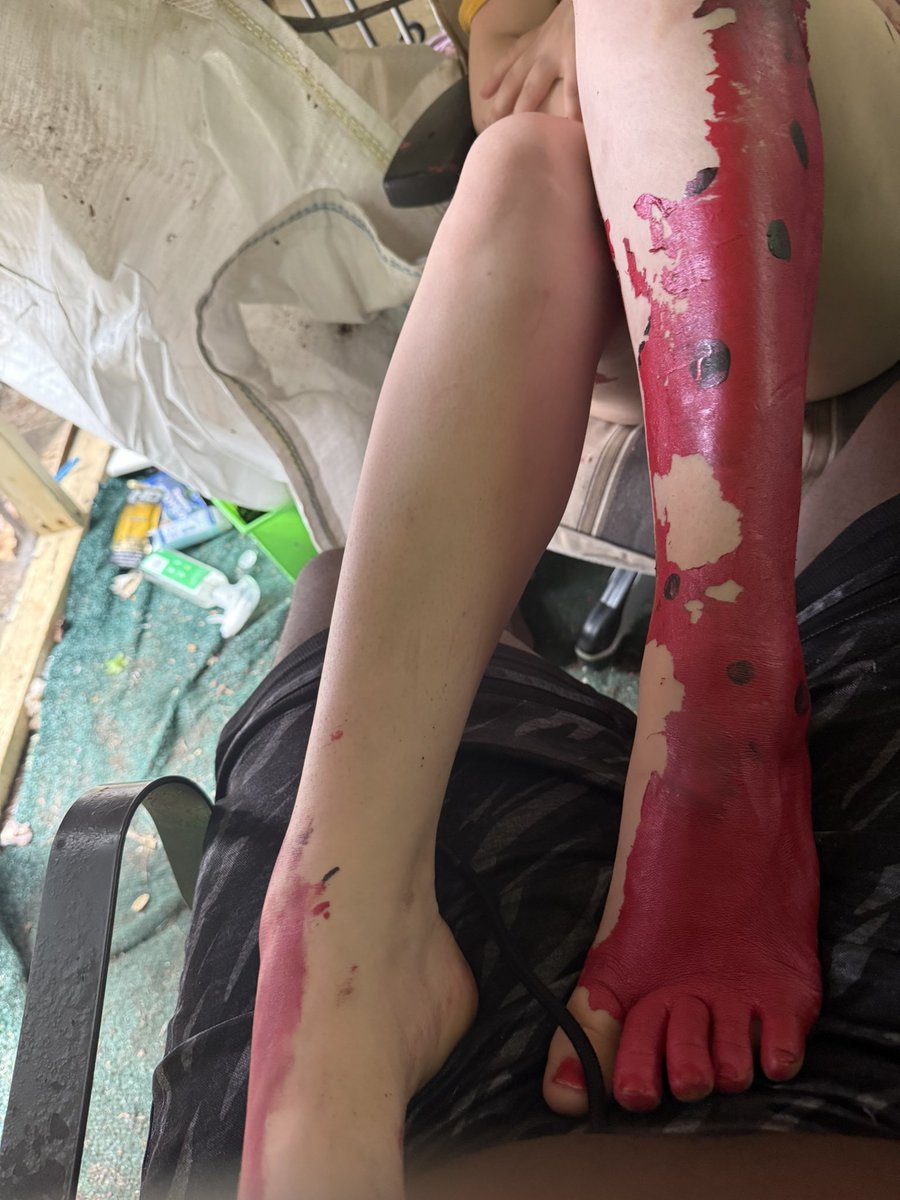 SHARKISTANMSP79's tweet photo. #paintedfeet #feet https://t.co/Ncc612bMLM