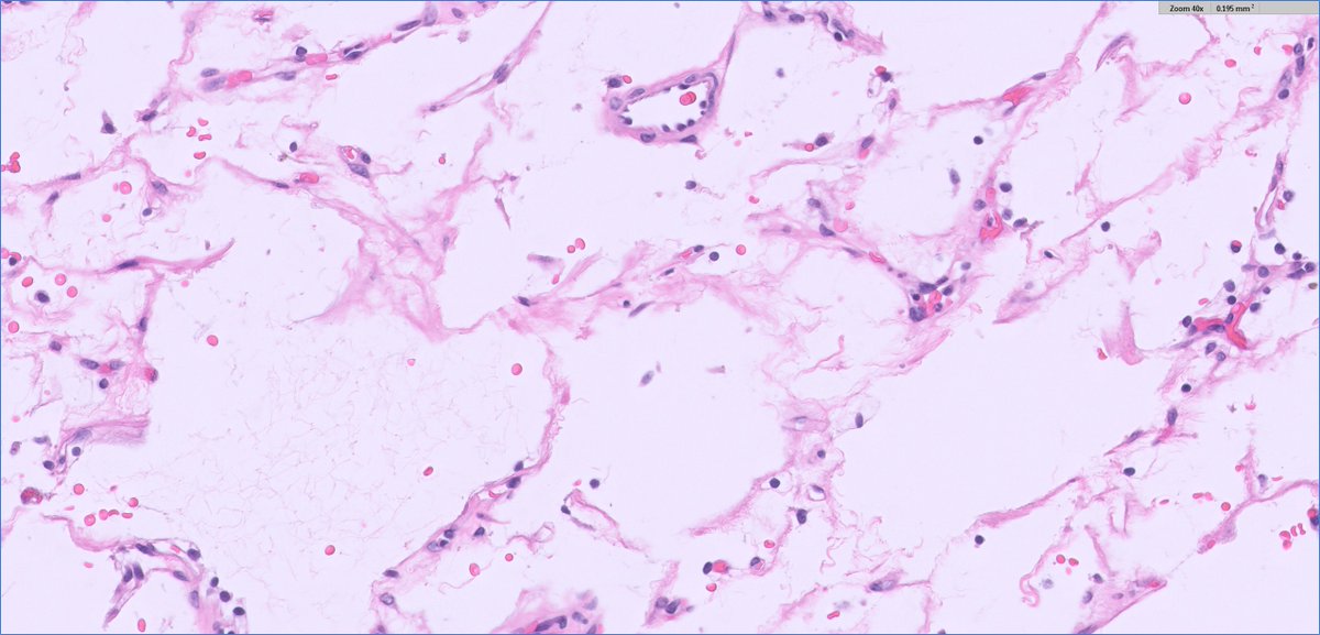 #GUpath #tooclosetodiagnose❓or is it🤔
