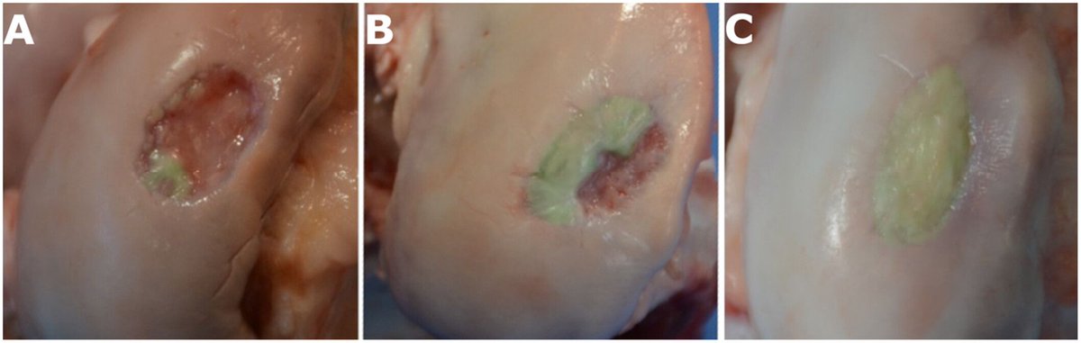 Brenna Pugliese (@brennapugliese) on Twitter photo Check out this new paper in <a href="/JOrthopRes/">Journal of Orthopaedic Research®</a> investigating a volume-based scoring technique to assess the extent of high-quality cartilage repair! The findings suggest the technique may improve reliability of arthroscopic cartilage repair assessment! #ORSSMC
🔗 buff.ly/qQJPQit Check out this new paper in <a href="/JOrthopRes/">Journal of Orthopaedic Research®</a> investigating a volume-based scoring technique to assess the extent of high-quality cartilage repair! The findings suggest the technique may improve reliability of arthroscopic cartilage repair assessment! #ORSSMC
🔗 buff.ly/qQJPQit