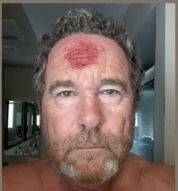 Numbskull of the day.
Looking down from an overpass that they are throwing rocks at the cops from and he can't understand why he got hit by a rubber bullet.