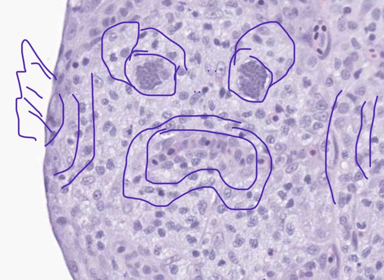 <a href="/VetPathophile/">Dr Nicola Parry</a> Clear case of sadfish.