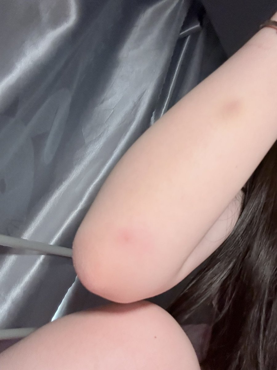 媒体预览