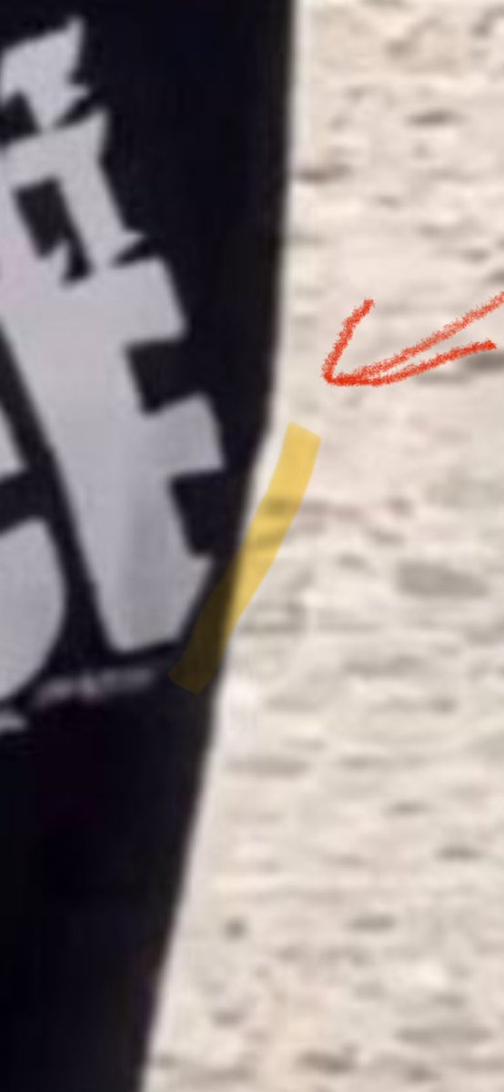 Fertperu's tweet photo. @GreyGhostG59 @PetTender44 @Economistflaite @Sadie_NC It’s a wrinkle. You can clearly see the angle of it https://t.co/SuVynSJeex