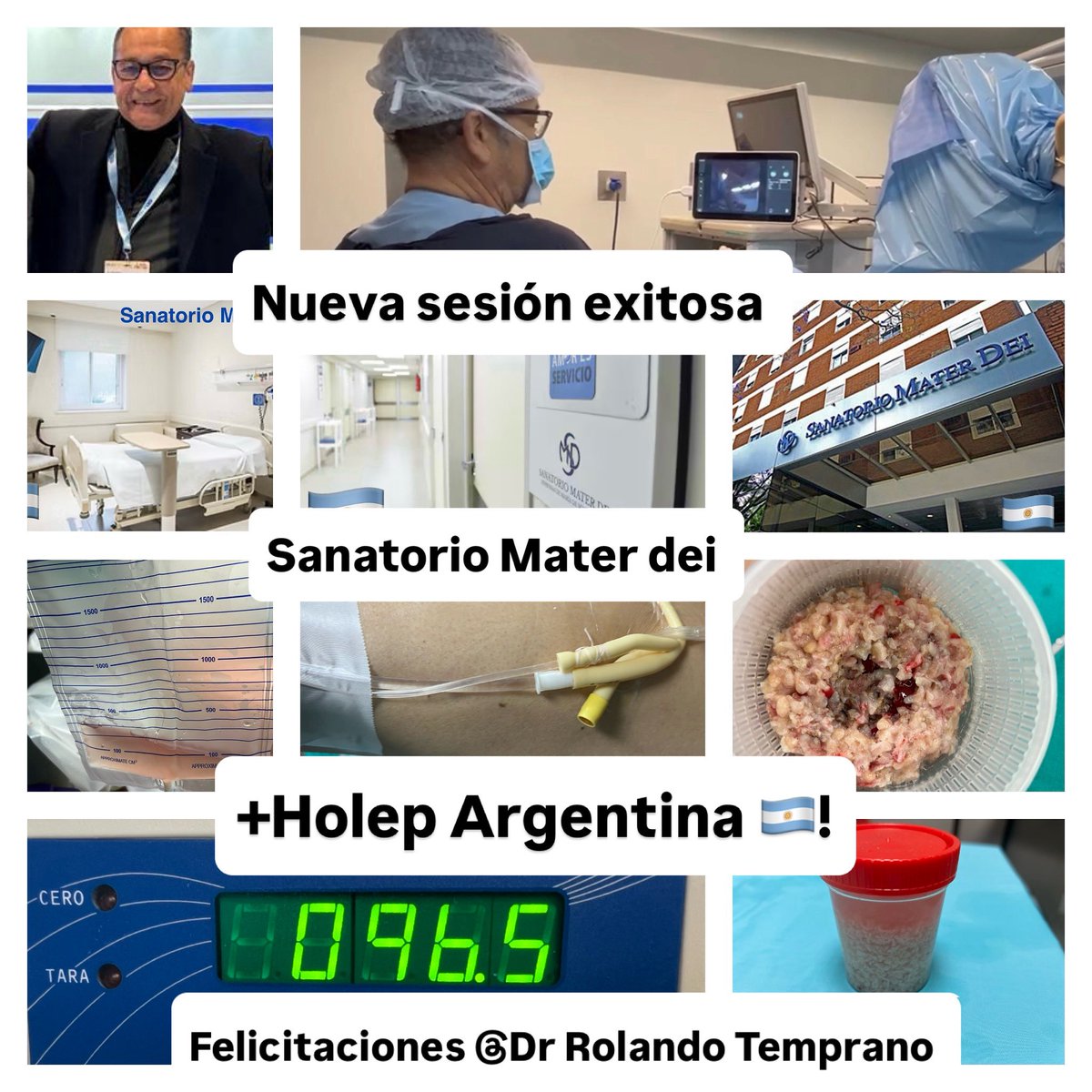 En sanatorio Mater Dei el Equipo UROLAS contamos con un activo programa de enucleacion prostatica con laser Holmio ( Holep)para resolucion de patologia obstructiva Prostatica, una tecnica depurada y lo ultimo en tecnologia #HolepArgentina #Holep #sanatoriomaterdei