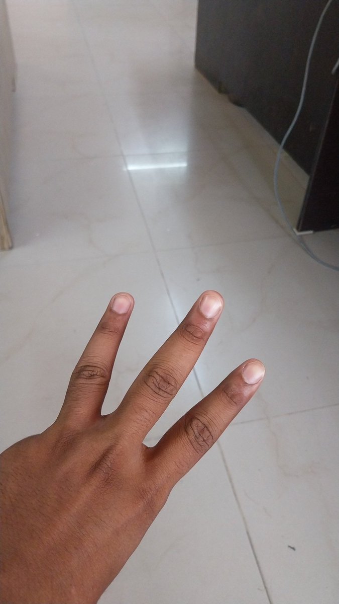 Everywhere watcher is everywhere
#denet <a href="/DeNetPro/">DeNet</a> #Watcher #WatchersEverywhere