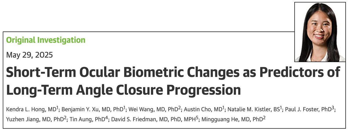 Benjamin Xu, MD, PhD (@benxulab) on Twitter photo Congratulations to stellar <a href="/USCEye/">USC Roski Eye Institute</a> PGY3, Kendra Hong, in our most recent collaboration with the ZAP Trial team! We showed that short-term changes in the lens and angle in AS-OCT images can help predict long-term #angleclosure progression. #glaucoma
tinyurl.com/xulab13 Congratulations to stellar <a href="/USCEye/">USC Roski Eye Institute</a> PGY3, Kendra Hong, in our most recent collaboration with the ZAP Trial team! We showed that short-term changes in the lens and angle in AS-OCT images can help predict long-term #angleclosure progression. #glaucoma
tinyurl.com/xulab13