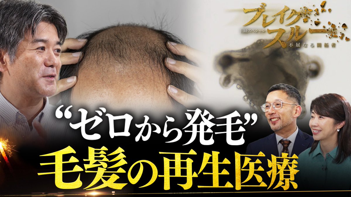 TX_breakthrough's tweet image. 自分の毛髪を大量培養する世界初の薄毛治療法!今後、ビッグビジネスに発展させて、あらゆる再生医療に貢献しようと奮闘する開拓者に作家・相場英雄が迫る!
今週14日(土)午前10時30分〜
テレ東系で放送!