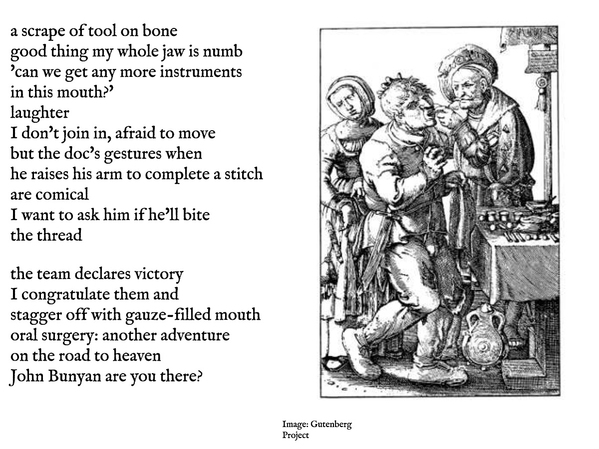 d_gheorgheni's tweet image. #vss365 #scrape