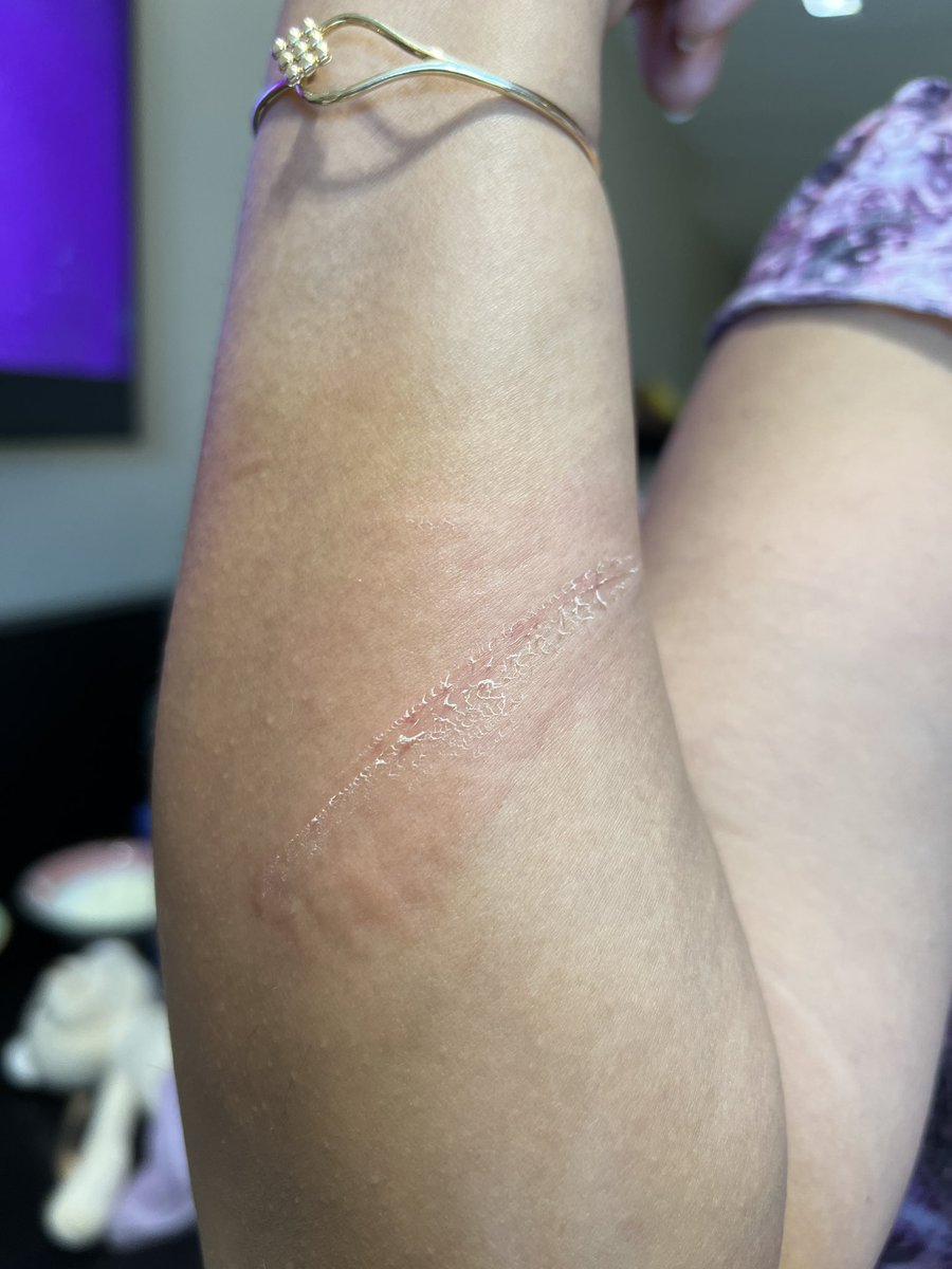 mahajanrajeev's tweet image. Thank you @TajHotels @TataCompanies for “wonderful” holiday you have provided us at Taj Bentota, a holiday that began with injury due to criminal negligence of your staff &amp;amp; GM, Sibi Matthew 
Taj loyalists stay clear of this property - terrible attitude &amp;amp; rundown property