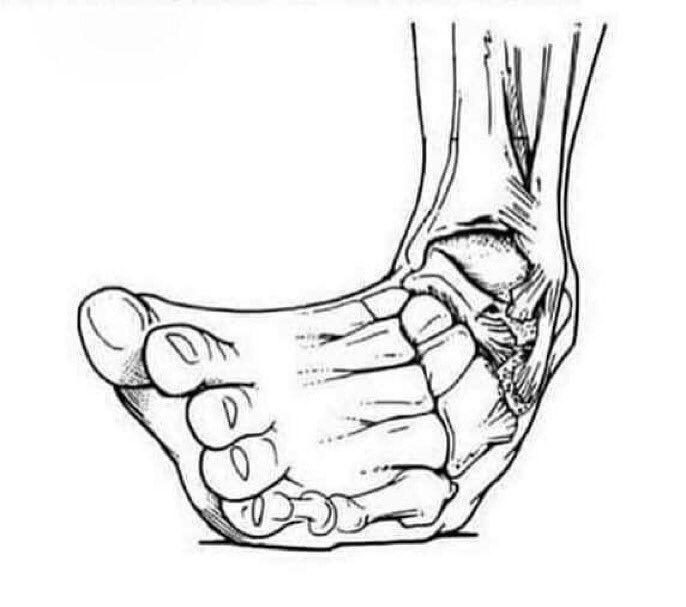 You didn't play football properly if you didn't feel this pain. 😂😭