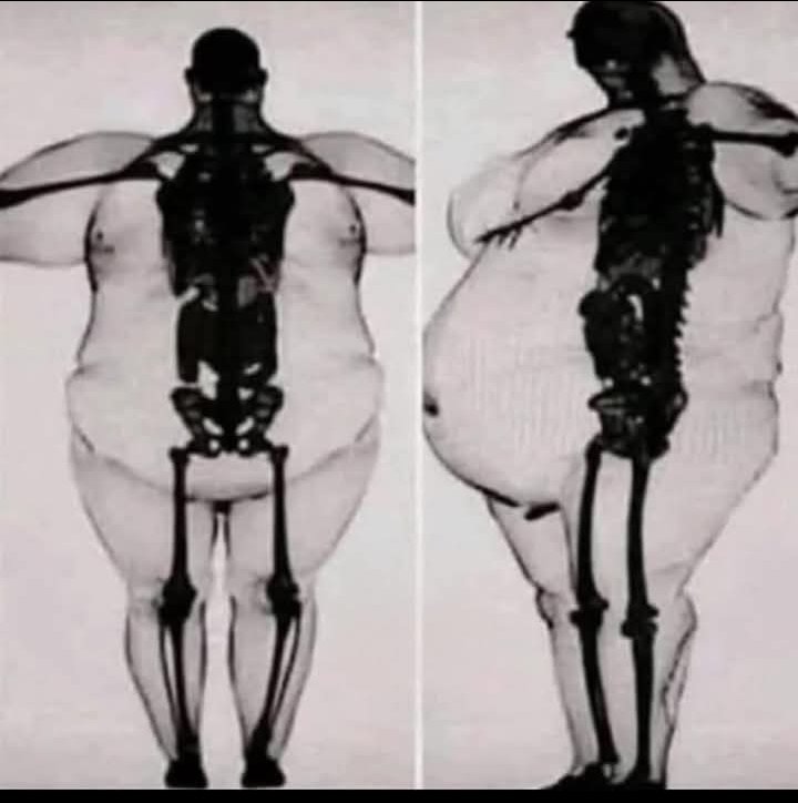 Люди с широкой костью