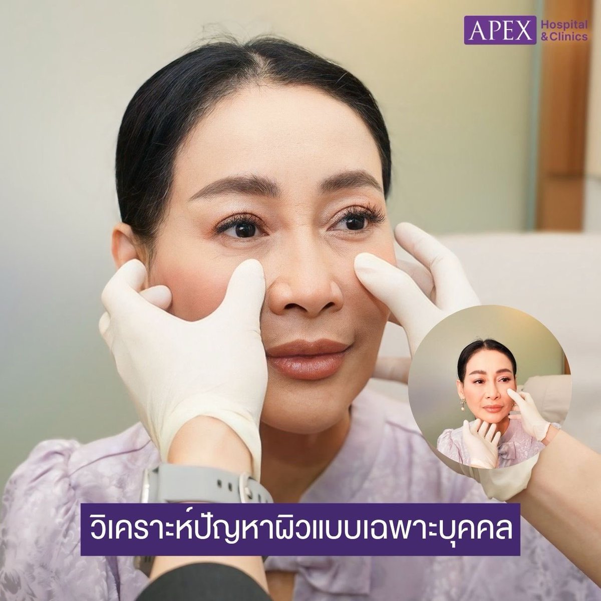 Apex Beauty Clinic tweet media
